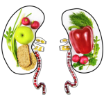 kidney diet outline